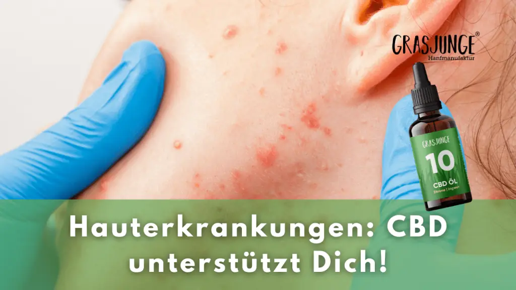 CBD bei Hauterkrankungen